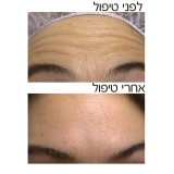 Афродита-центр красоты и эстетики в Бат-Яме 