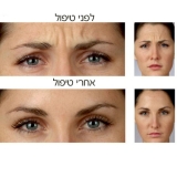 Афродита-центр красоты и эстетики в Бат-Яме 