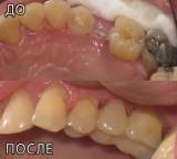 Стоматолог в Кирьят-Гате Ирина Спевак Колчинская.