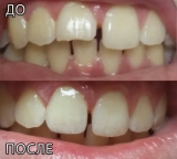 Стоматолог в Кирьят-Гате Ирина Спевак Колчинская.