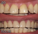 Стоматолог в Кирьят-Гате Ирина Спевак Колчинская.