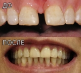 Стоматолог в Кирьят-Гате Ирина Спевак Колчинская.